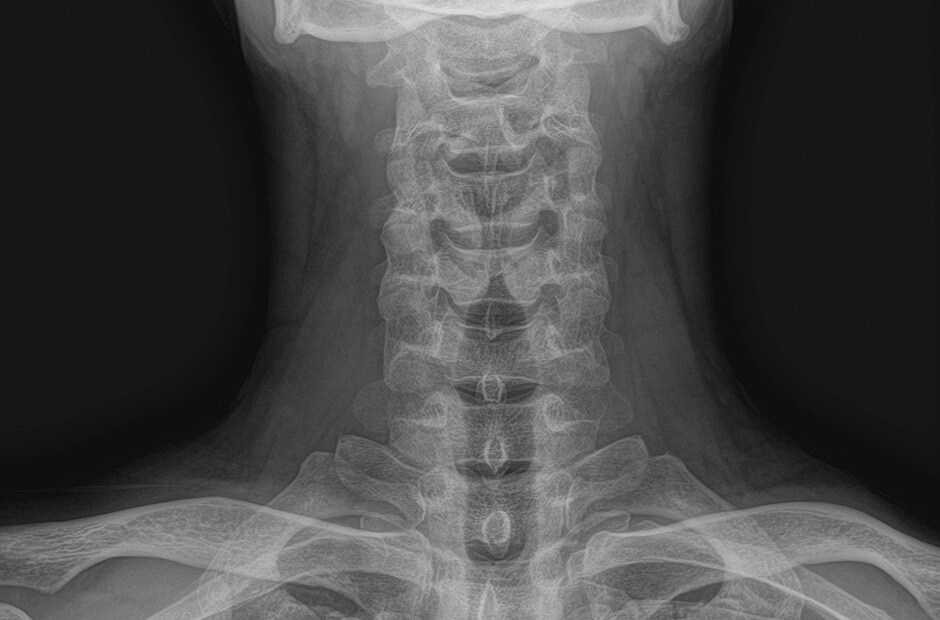 ภาพ X-ray รูปที่ 1