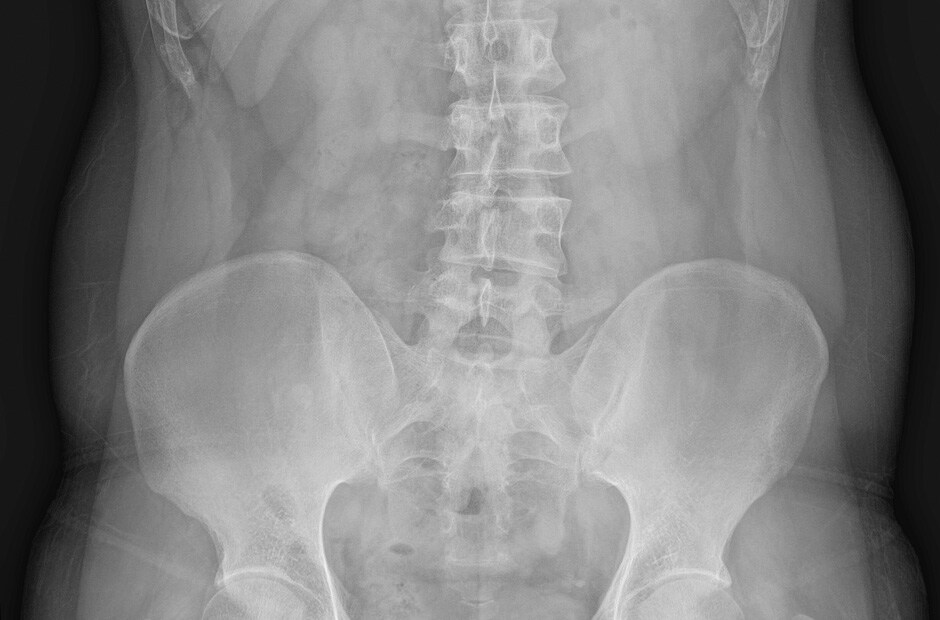 ภาพ X-ray รูปที่ 3