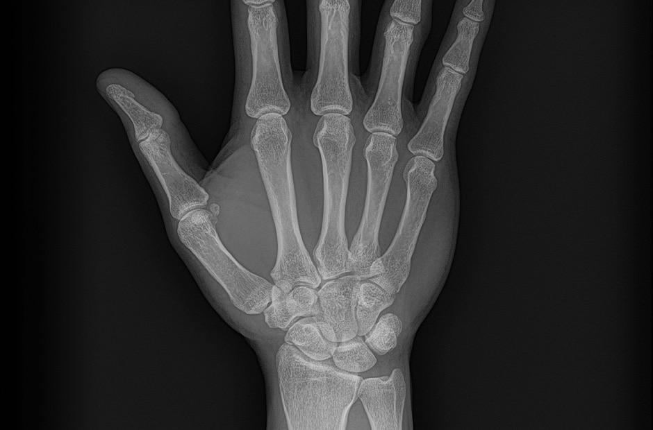 ภาพ X-ray รูปที่ 4