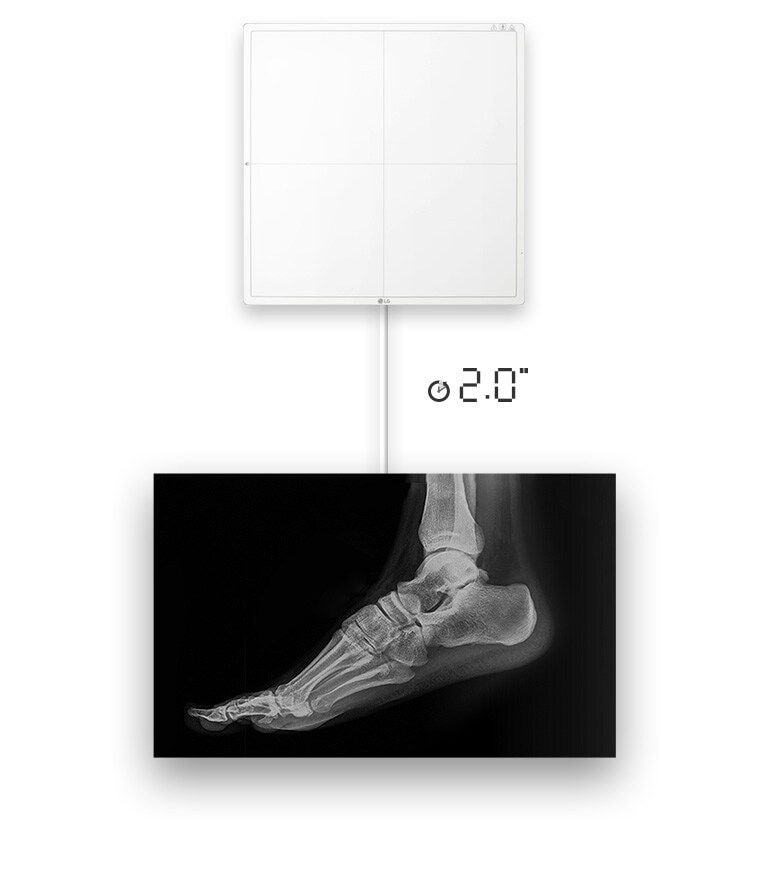 Image availability in 2 seconds with a wired connection.