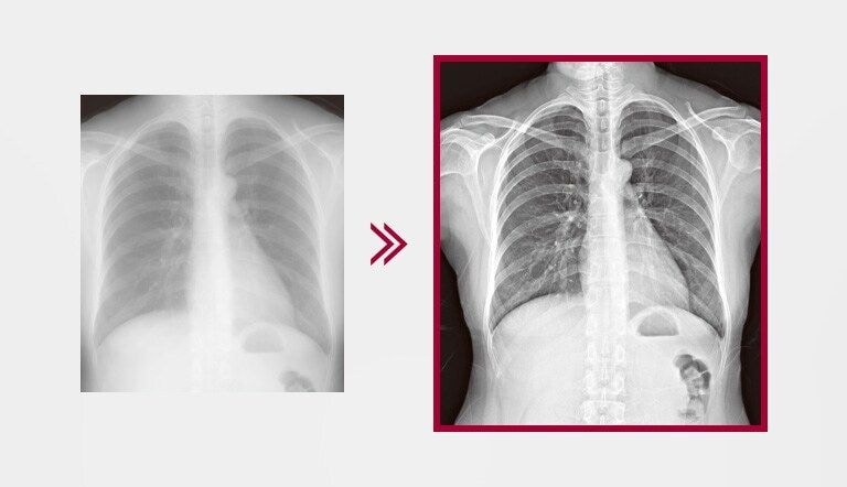 The more finely detailed image result using Multi-layer Image Processing embedded in the AWS, comparing to the image result without Multi-layer Image Processing