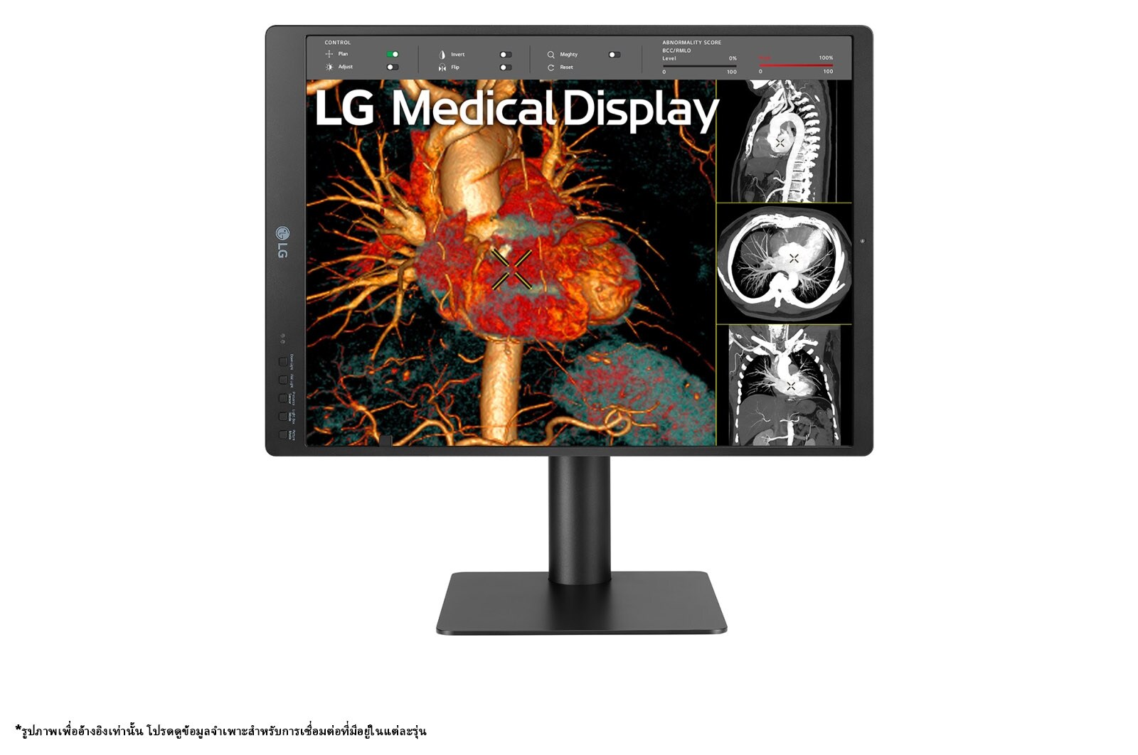 LG 21.3'' 3MP IPS Diagnostic Monitor, 21HQ513D-B