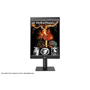 มุมมองด้านหน้าของ LG 21.3&#39;&#39; 3MP IPS Diagnostic Monitor 21HQ513D-B