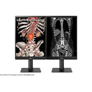 LG 21.3'' 3MP IPS Diagnostic Monitor, 21HQ513D-B