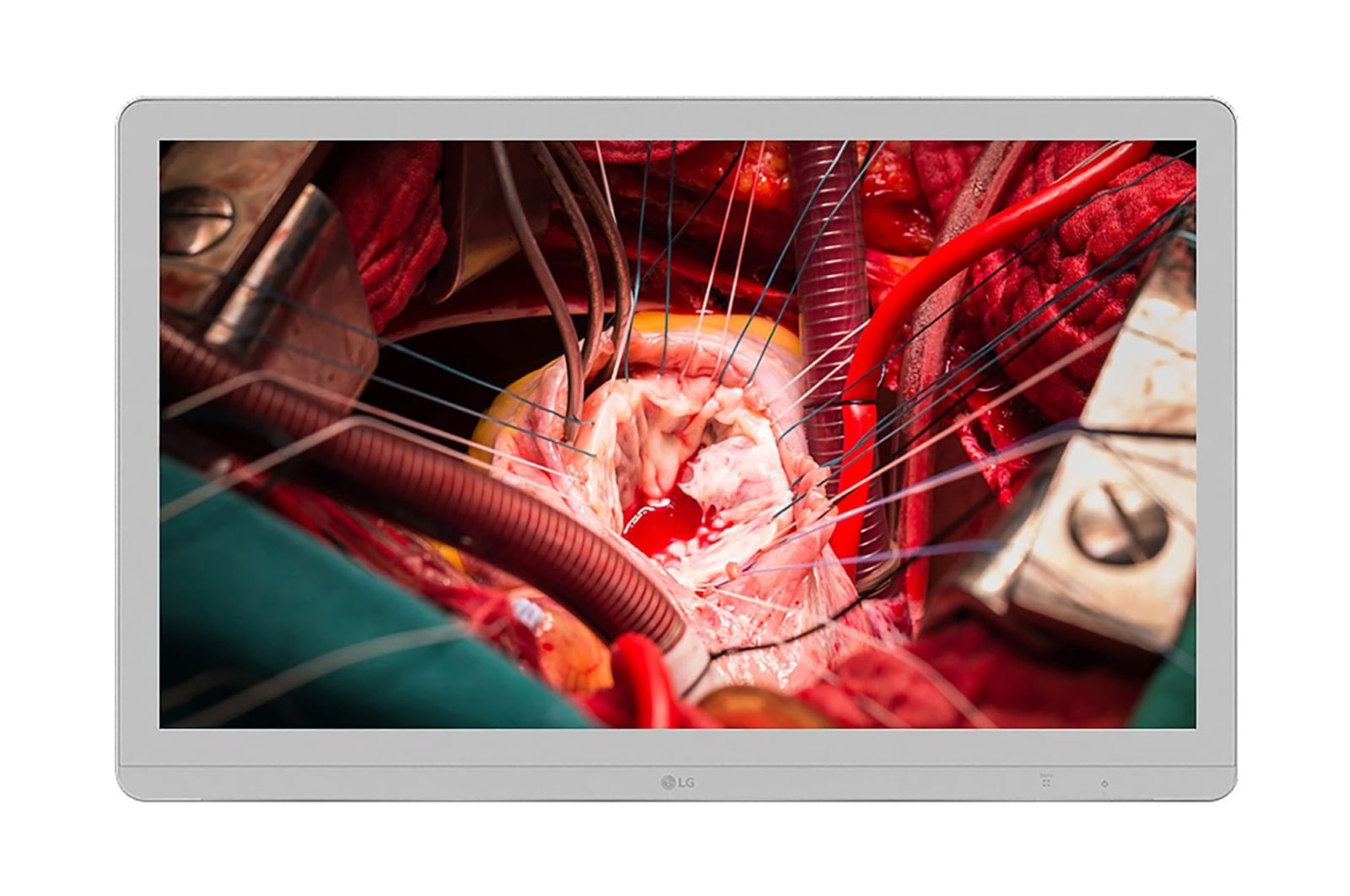 มุมมองด้านหน้าของ LG 27&#39;&#39; 4K IPS Surgical Monitor 27HJ710S-W