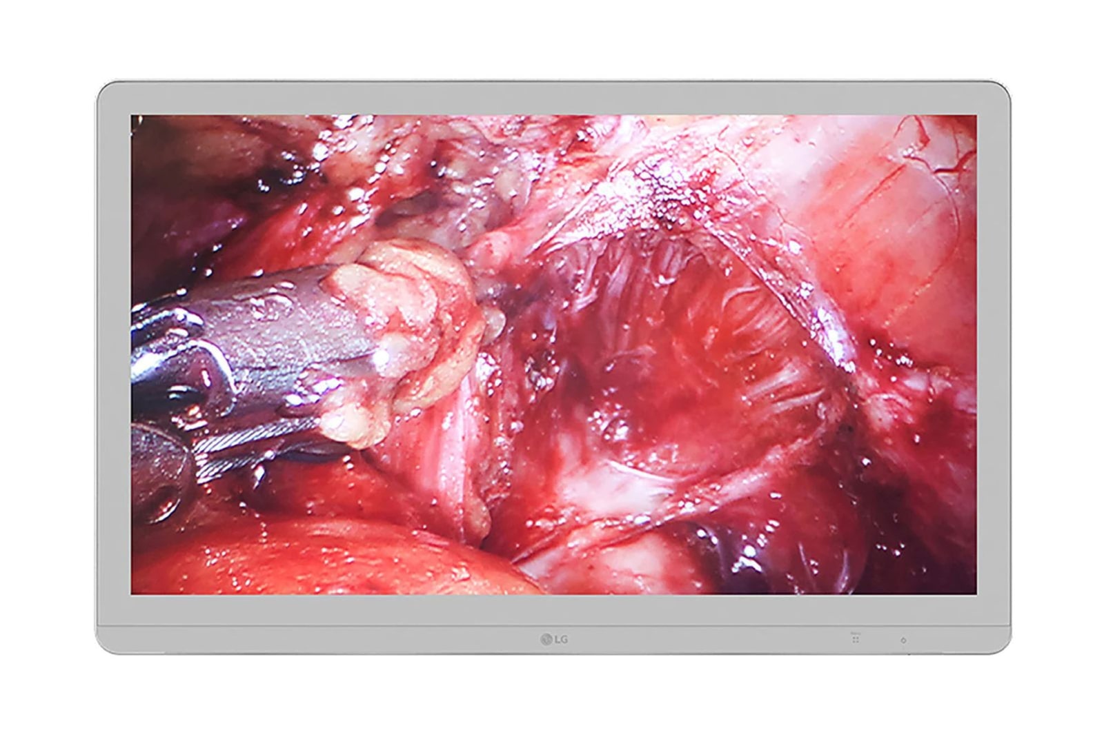 LG 27'' 4K IPS Surgical Monitor, 27HJ710S-W