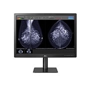 LG  LG 31'' 12MP 4200 x 2800 IPS Diagnostic Monitor for Mammography, 31HN713D
