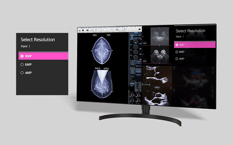 multi-resolution mode offering for users to select resolution between input of 4MP, 6MP and of 8MP
