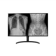 มุมมองด้านหน้าของ LG 8MP Diagnostic Monitor 32HL512D