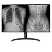 31,5&#39;&#39; 8MP (3840x2160) IPS Teşhis Monitörü 32HL512D-B için önden görünüm