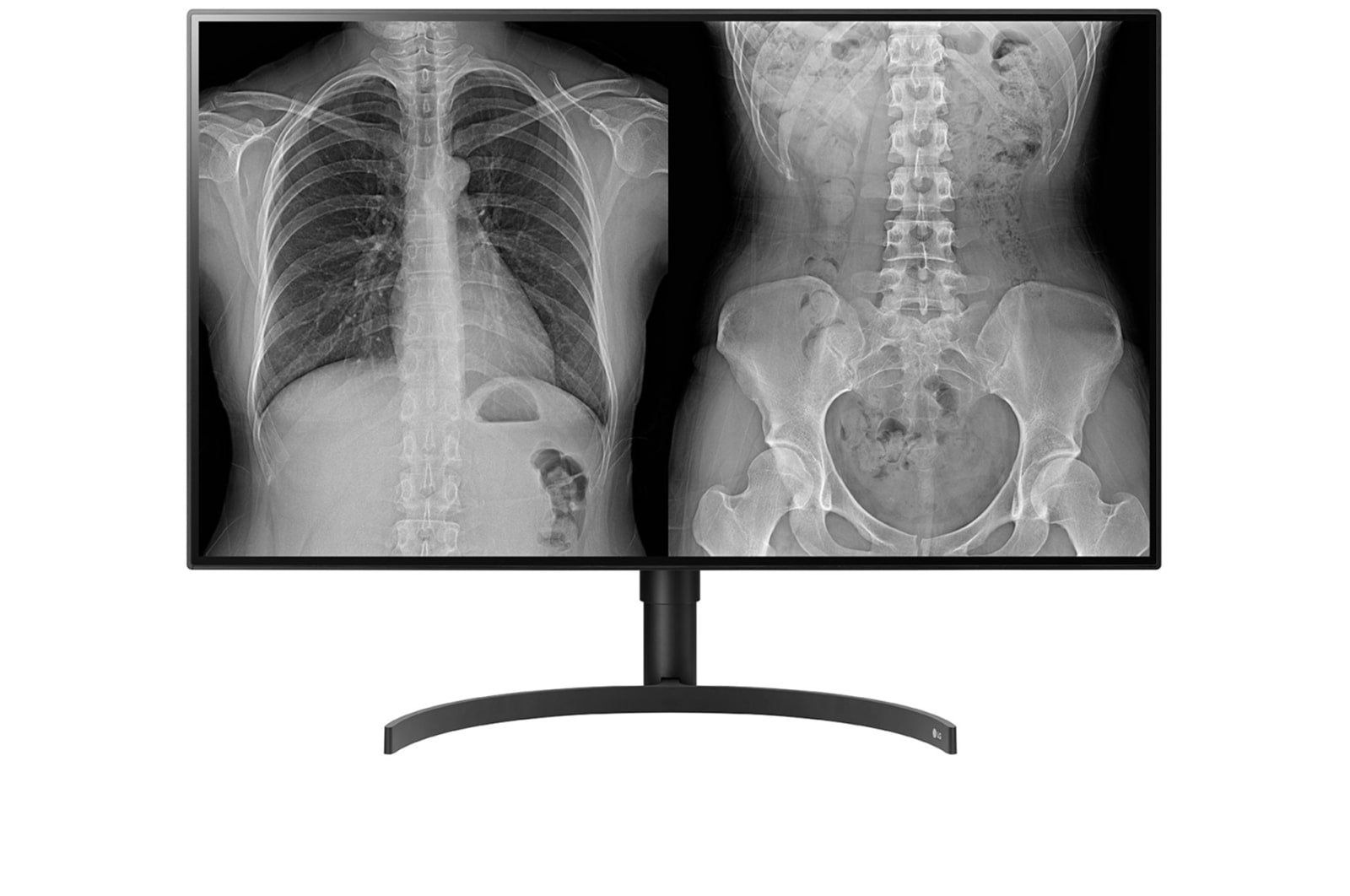 31,5&#39;&#39; 8MP (3840x2160) IPS Teşhis Monitörü 32HL512D-B için önden görünüm