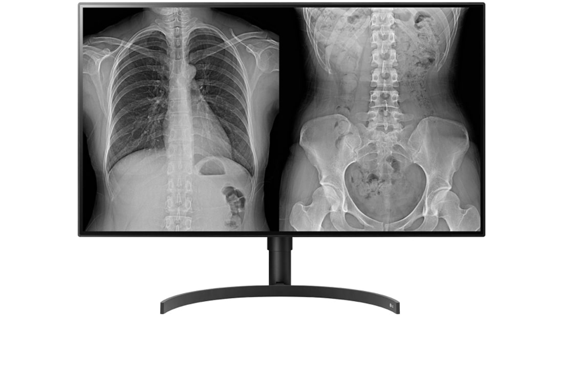 LG 31,5'' 8MP (3840x2160) IPS Teşhis Monitörü, 32HL512D-B