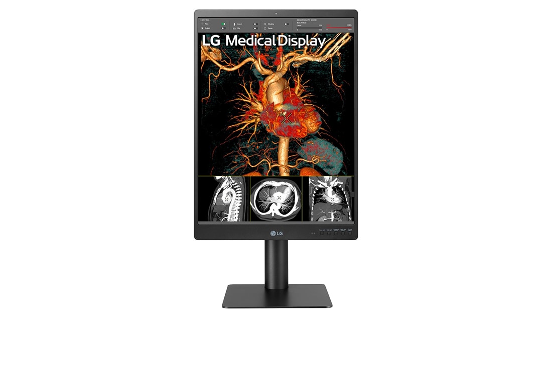 LG Diyagnostik Medikal Monitör 21,3 İnç 3MP Patoloji  Odak Görünümü Modu IPS Ekran, 21HQ513D-B