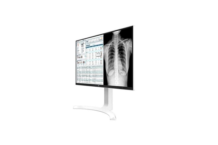 LG Klinik İnceleme Monitörü 27 İnç 8MP 3840x2160 UHD / IPS Ekran Tepki Süresi 14ms, 27HJ712C-W