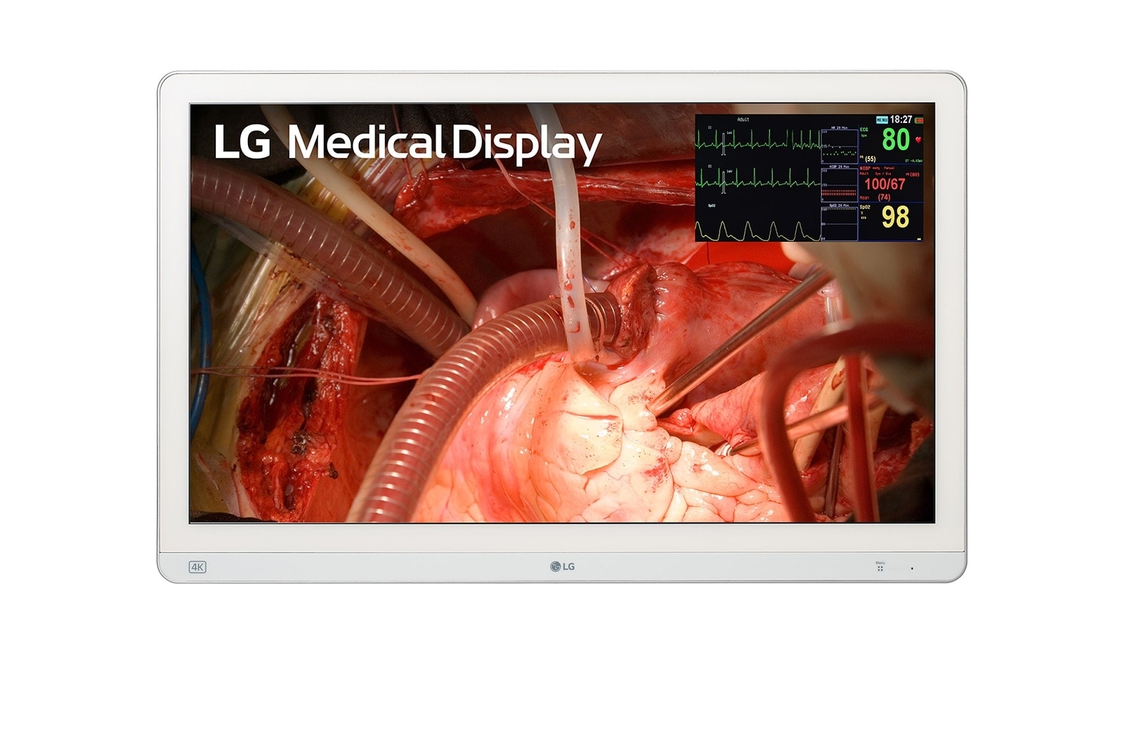 27 inç 4K Mini-LED Cerrahi Monitör 27HQ710S-W için önden görünüm