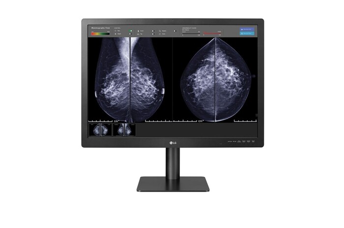 LG Mamografi Teşhis Monitörü 31 İnç 12 MP 4200x2800 Patoloji Odak Görünümü Modu IPS Ekran, 31HN713D-B