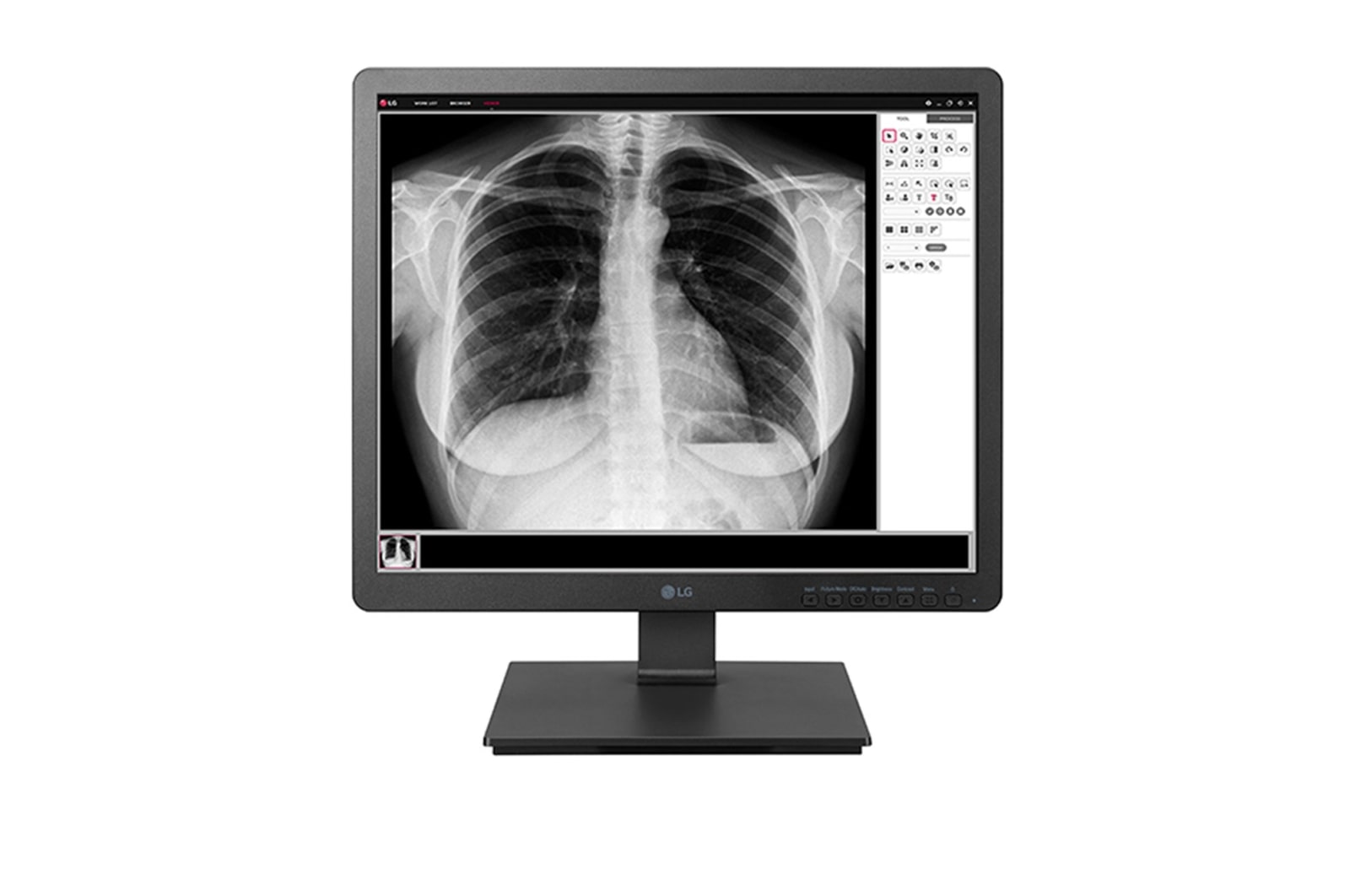 1.3 MP Klinik Değerlendirme Monitörü 19HK312C-B için önden görünüm