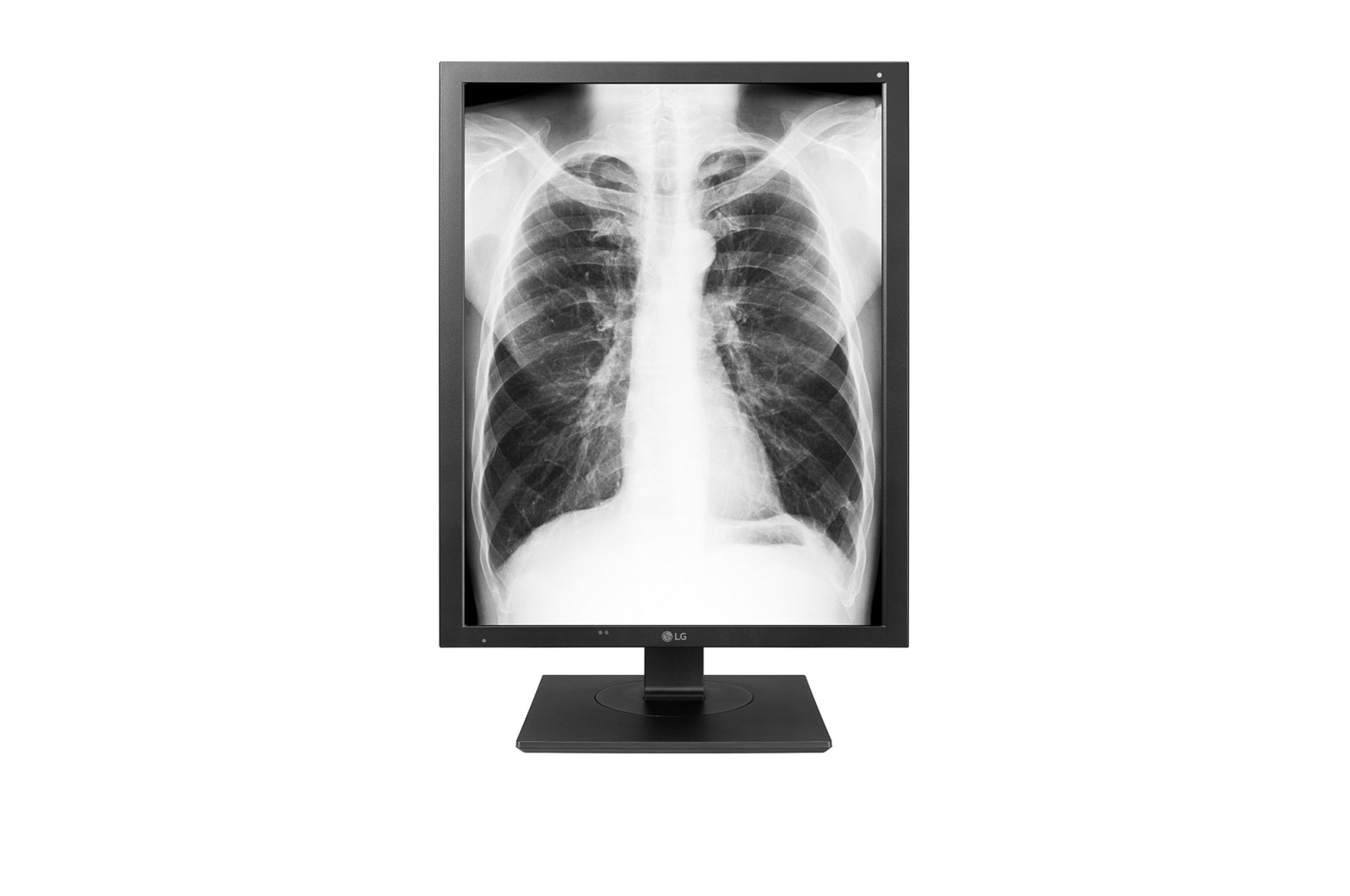 LG 3MP Teşhis Monitörü 21HK512D-B için önden görünüm