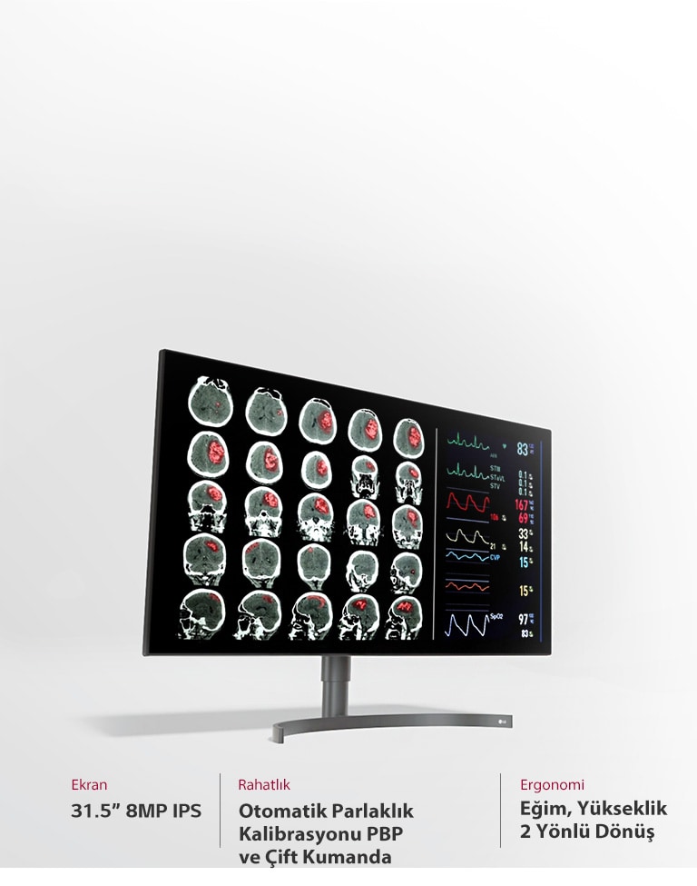 31,5" 8MP Teşhis Monitörü3