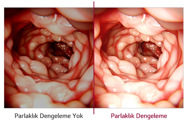 Parlaklık Dengeleme