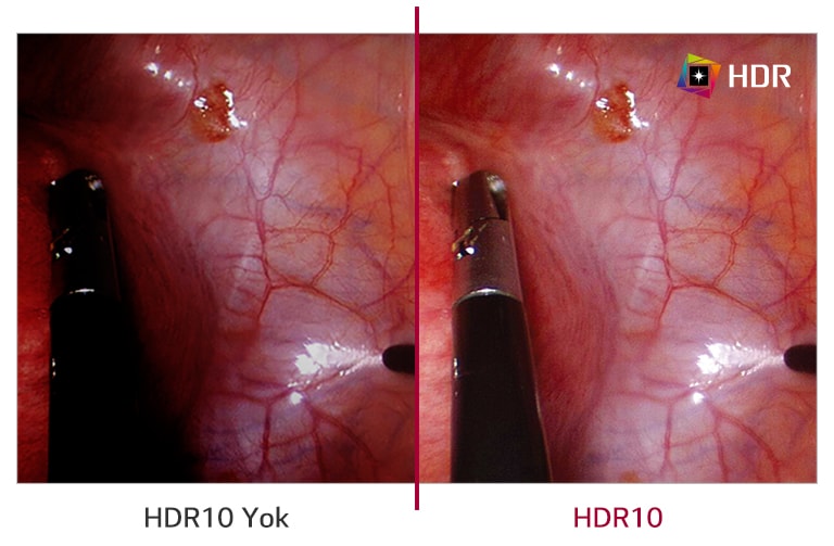 HDR10 desteği
