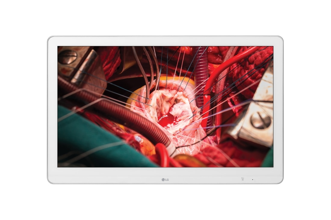 LG Full HD Cerrahi Monitör, 27HK510S-W