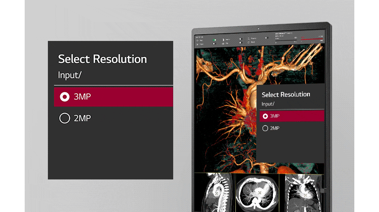 multi-resolution mode offering for users to select resolution between input of 3mp and of 2mp.
