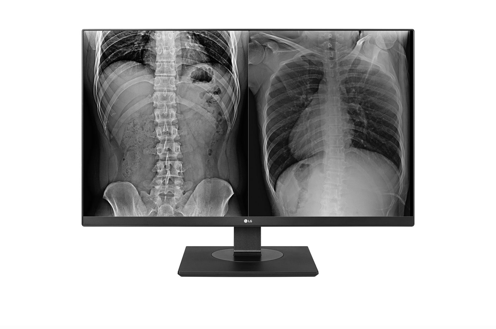 Front view of 27&#34; LG 8MP Clinical Review Monitor 27HJ713C-B