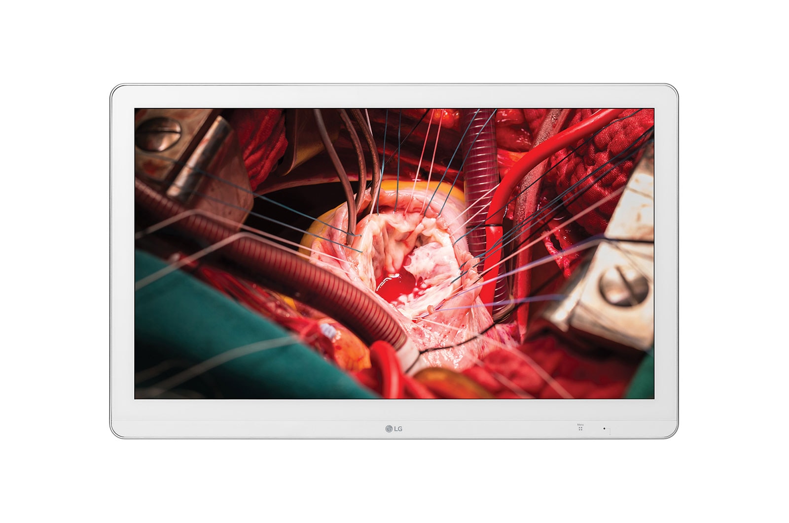 Front view of 27&#34; LG Full HD Surgical Monitor 27HK510S-W