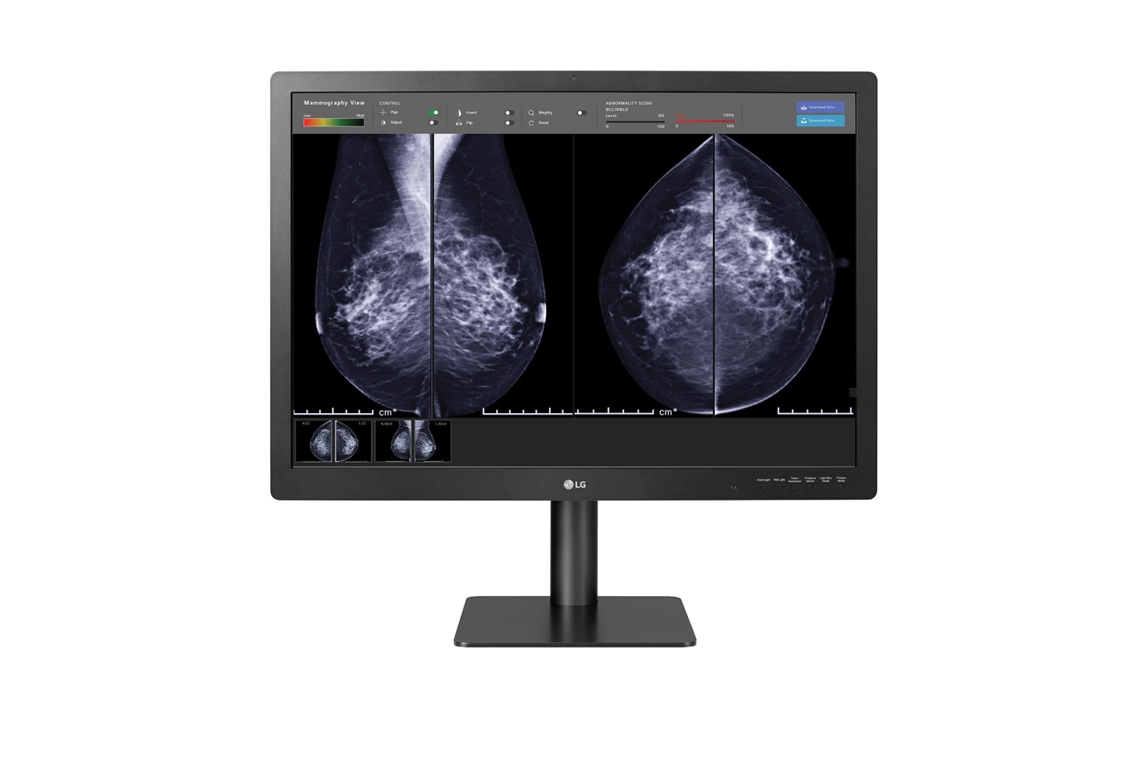 LG 31'' 12MP IPS Diagnostic Monitor for Mammography, 31HN713D