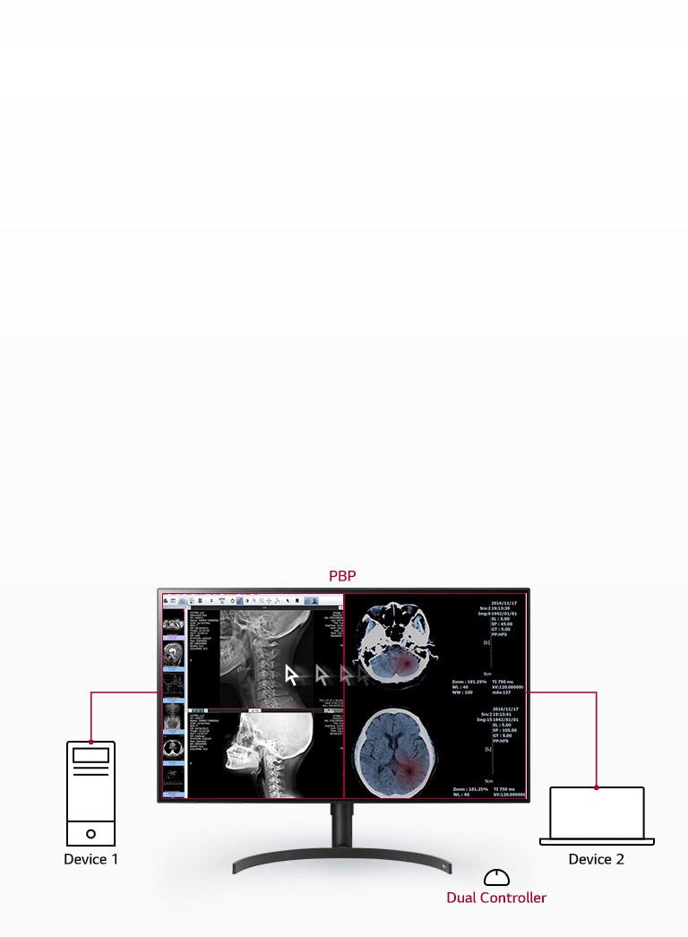 Multiple Signals on One Screen1