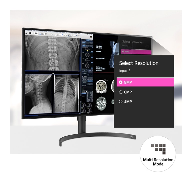 Multi Resolution Mode