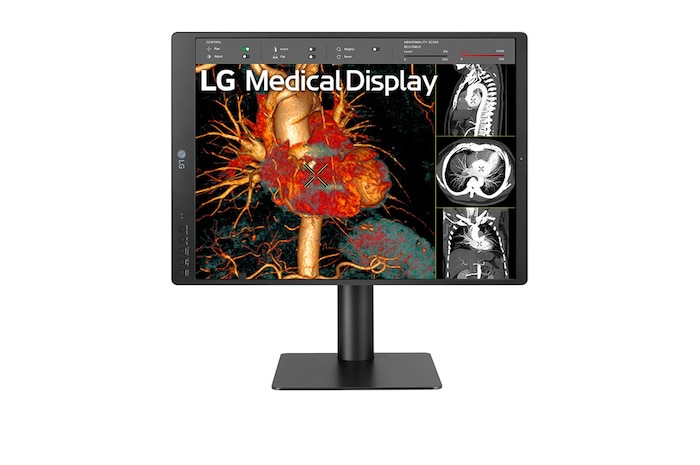 LG Màn hình chẩn đoán LG 3MP IPS 21,3'', 21HQ513D-B