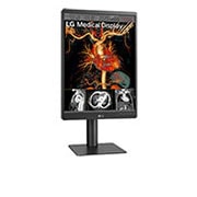 LG Màn hình chẩn đoán LG 3MP IPS 21,3'', 21HQ513D-B