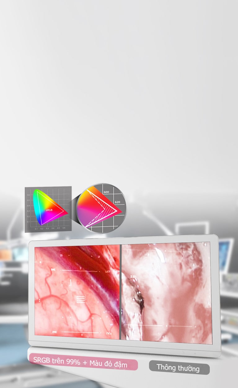 IPS & sRGB trên 99% + MÀU ĐỎ đậm1