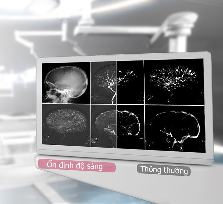 DICOM Part 14 và Ổn định độ sáng1