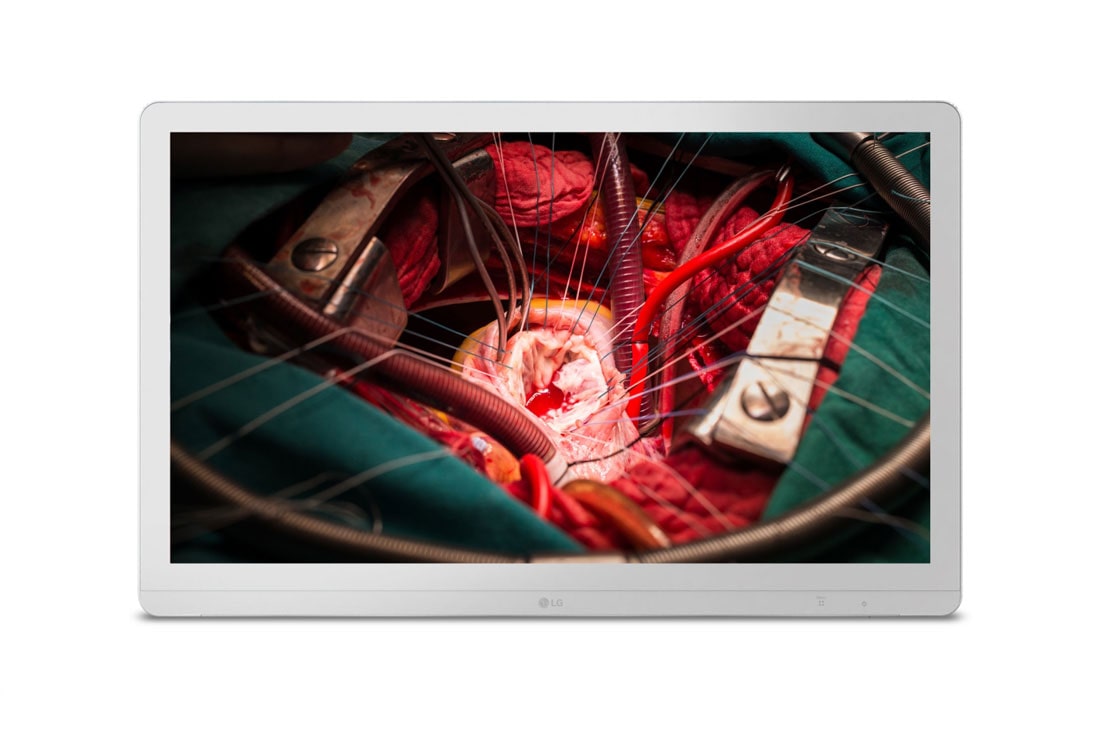 LG Màn hình phẫu thuật 27 inch (68,58cm) 4K, 27HJ710S