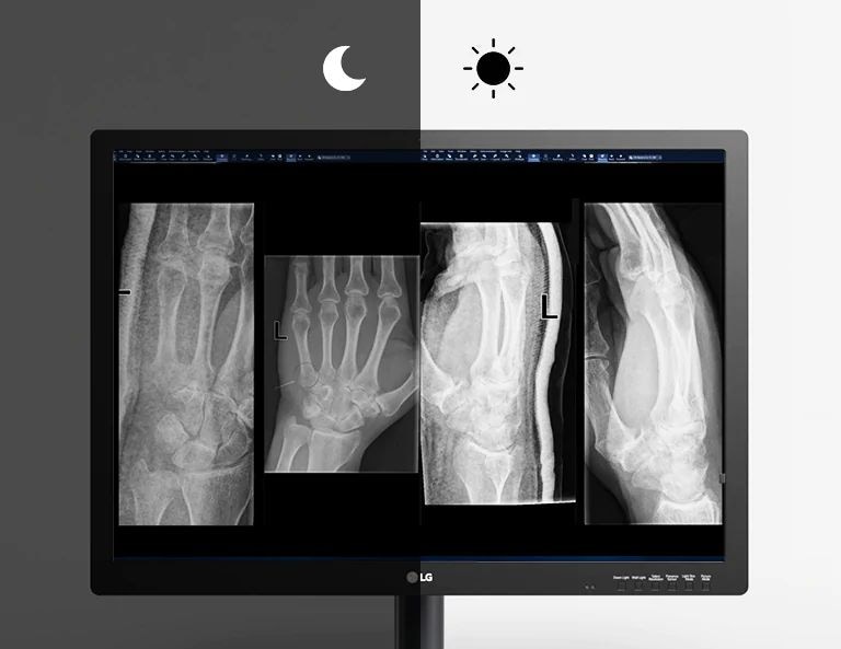 cảm biến độ sáng tự động giúp tự động điều chỉnh độ sáng của màn hình tới mức tối ưu theo điều kiện ánh sáng xung quanh