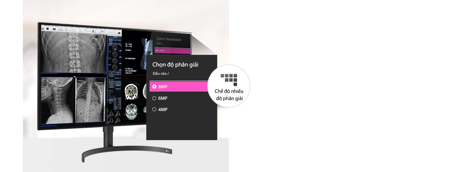 màn hình chẩn đoán