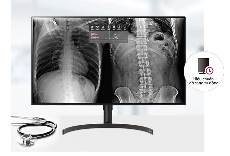 Chất lượng hình ảnh ổn định