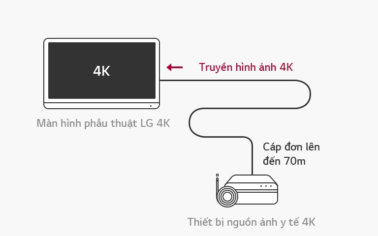 Hỗ trợ 12G-SDI : Màn hình phẫu thuật LG 4K cho phép truyền tín hiệu 4K trên khoảng cách xa qua một cáp đồng trục duy nhất mà không có độ trễ để có thể phẫu thuật ổn định.