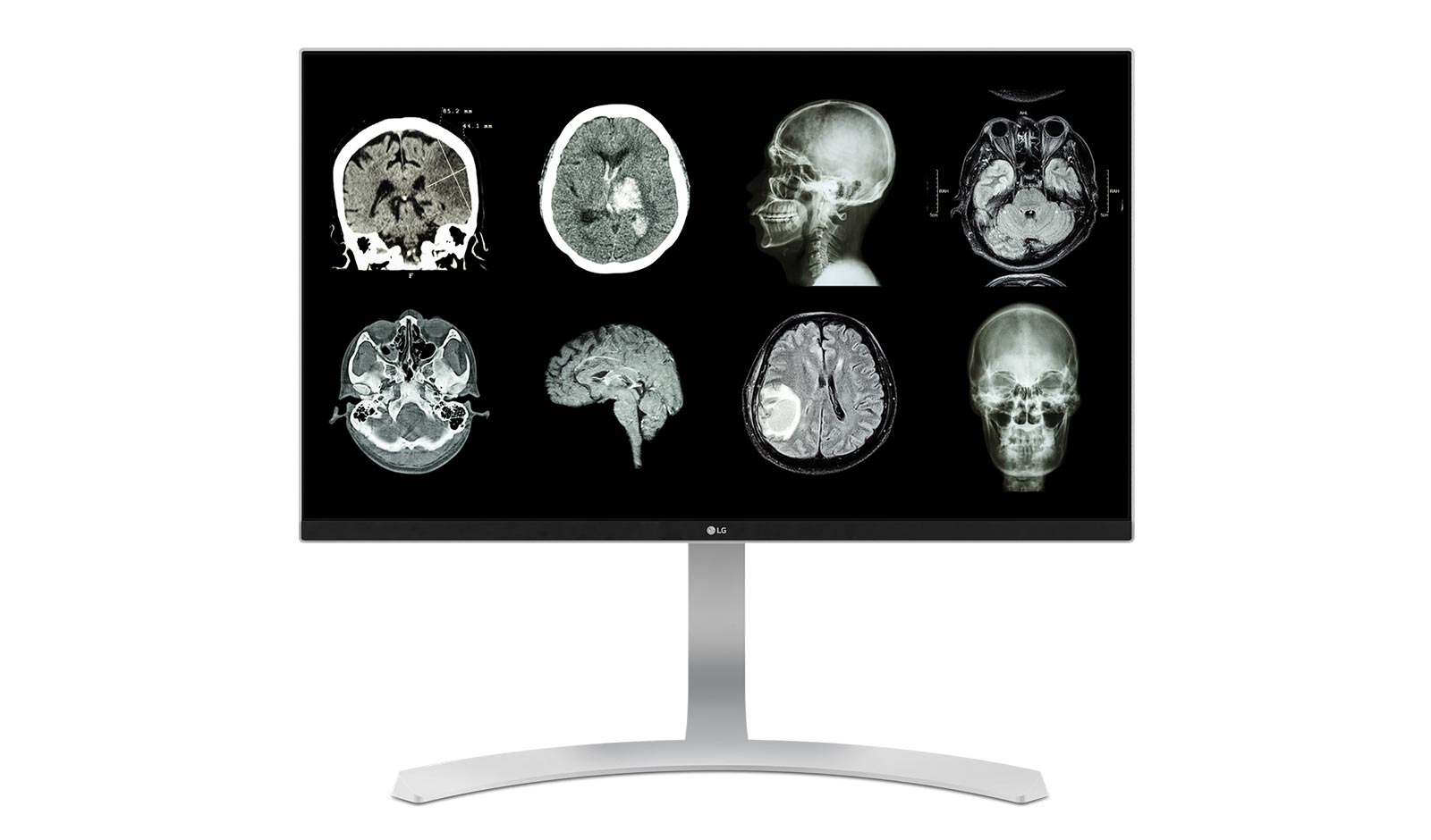 Hình ảnh mặt trước của 27&#34; 4K &amp; 5K UHD Màn hình y tế  27HJ712C-W