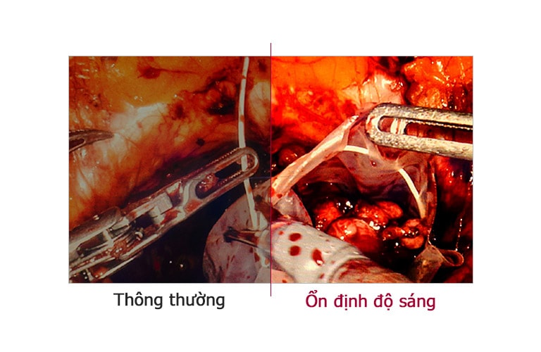 Độ sáng ổn định1