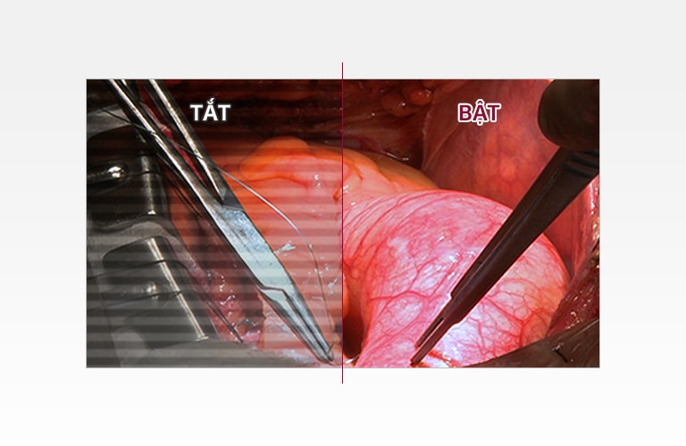 Giảm mệt mỏi thị giác1