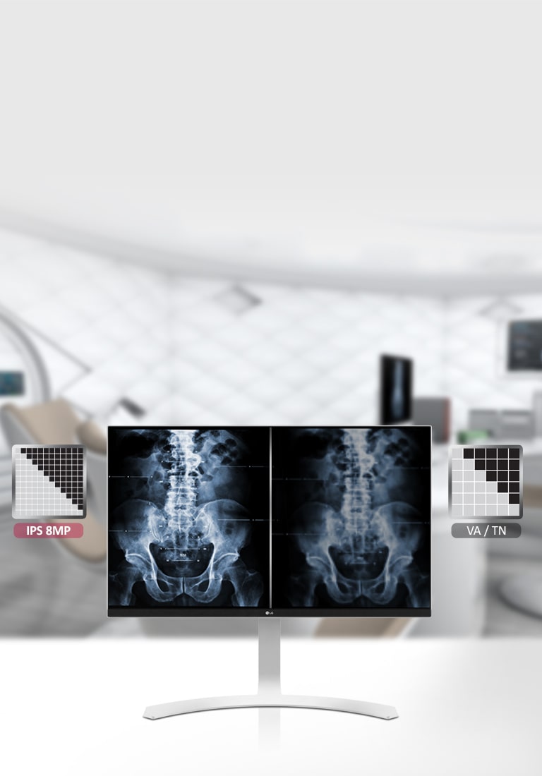 Màn hình y tế IPS 8MP<br>1