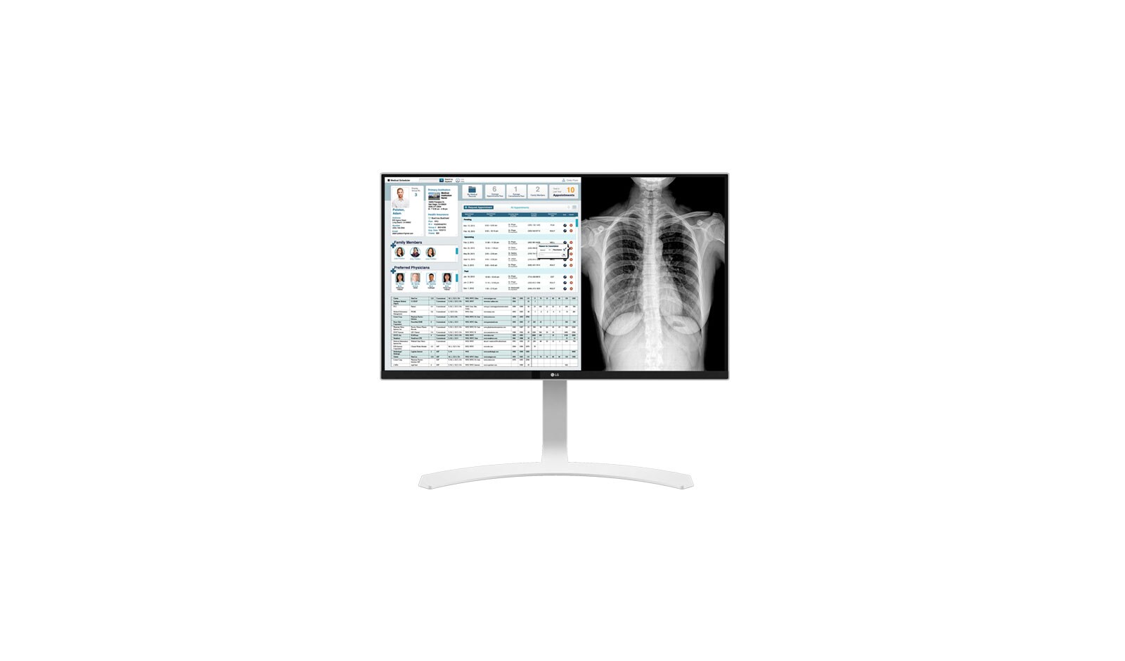 LG  8MP Clinical Review Monitor, 27HJ712C-W