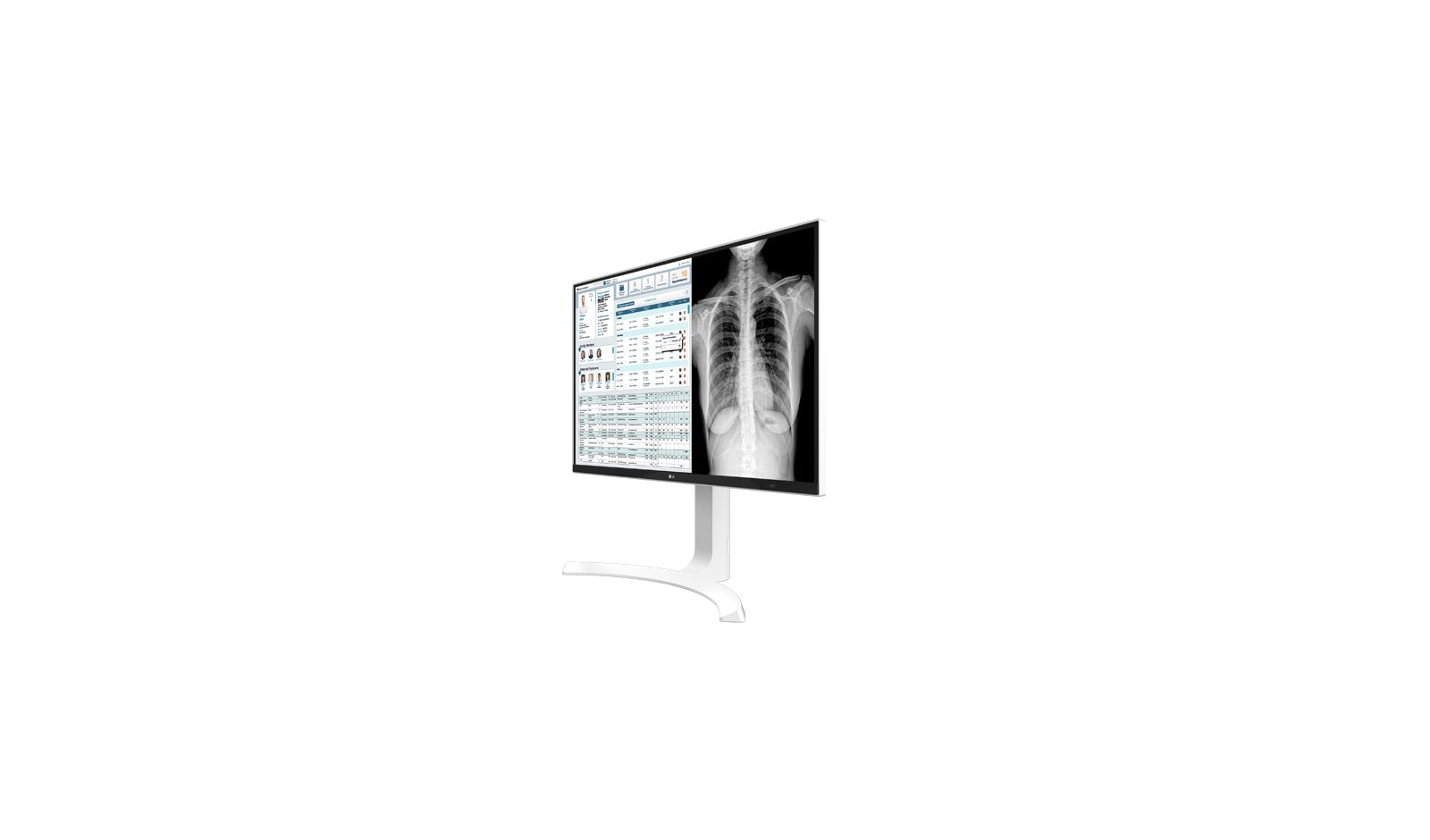 LG  8MP Clinical Review Monitor, 27HJ712C-W