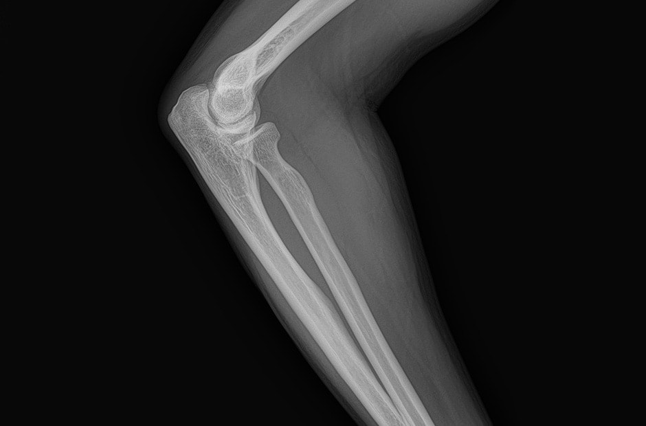 x-ray image