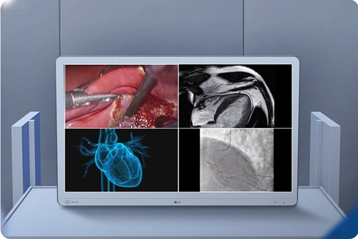 The video shows a medical monitor displaying up to four different types of information simultaneously, improving operational efficiency and decision-making.