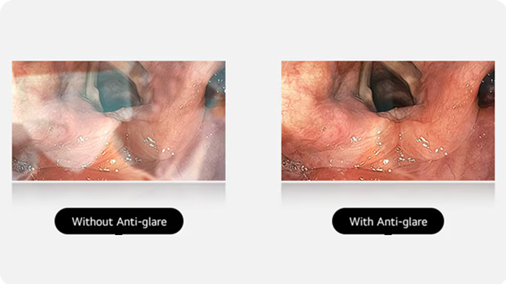 The left image shows a display without anti-glare, where reflections and glare obscure the view. The right image, with anti-glare coating, provides a clear and unobstructed view, demonstrating the effectiveness of the coating.